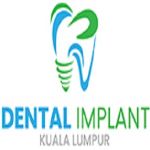 Dental Implant KL Clinic